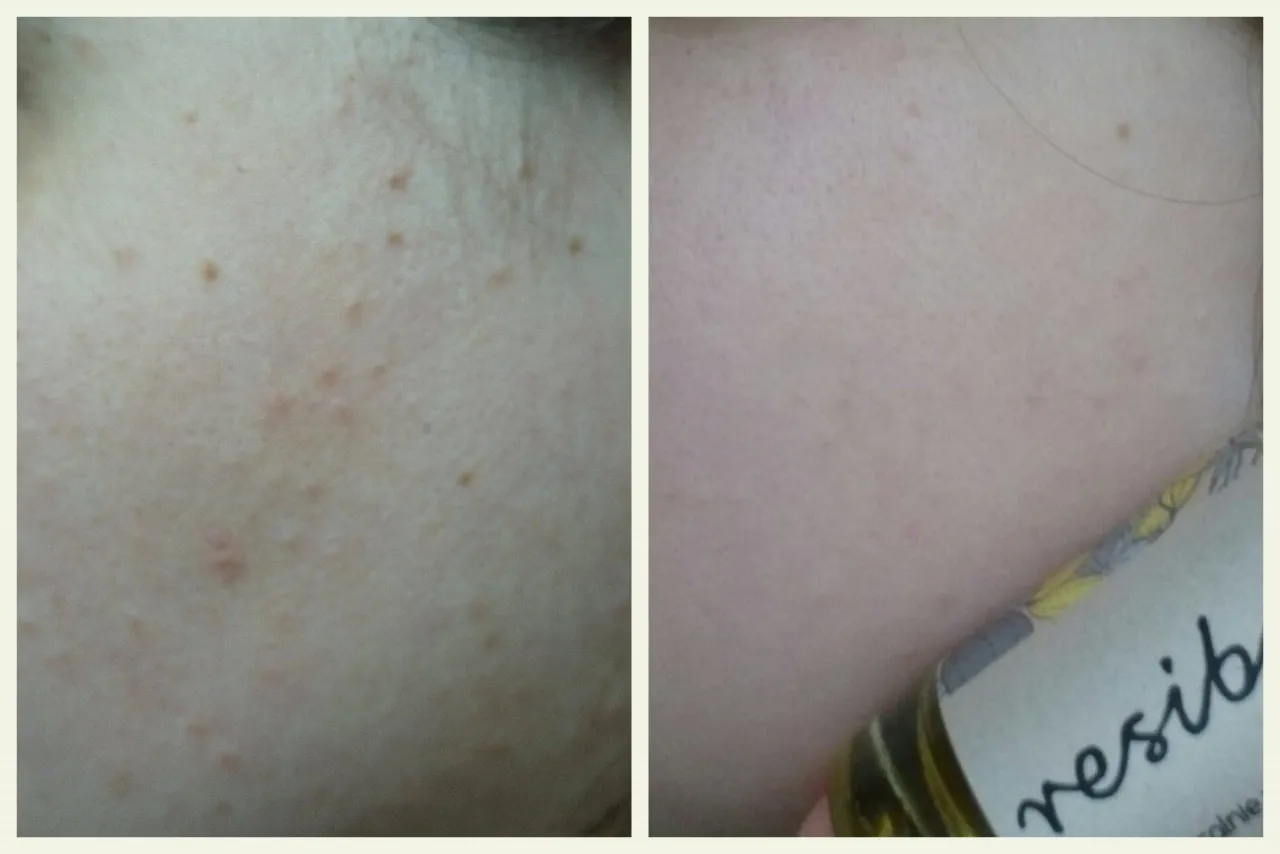 Zdjęcie Czy serum przed czy po maseczce? Sprawdź, jak uniknąć błędów w pielęgnacji