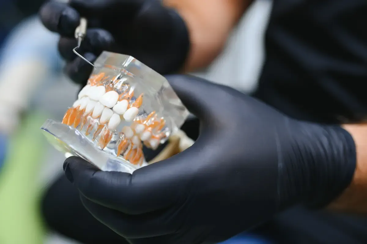 Zdjęcie Jak długo goją się dziąsła pod protezę? Sprawdź, co musisz wiedzieć