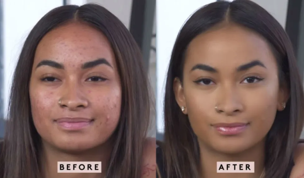 Zdjęcie Jak zamaskować pryszcze? Skuteczny makijaż krok po kroku