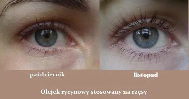Zdjęcie Olejek rycynowy na rzęsy: fakty, efekty i jak stosować?