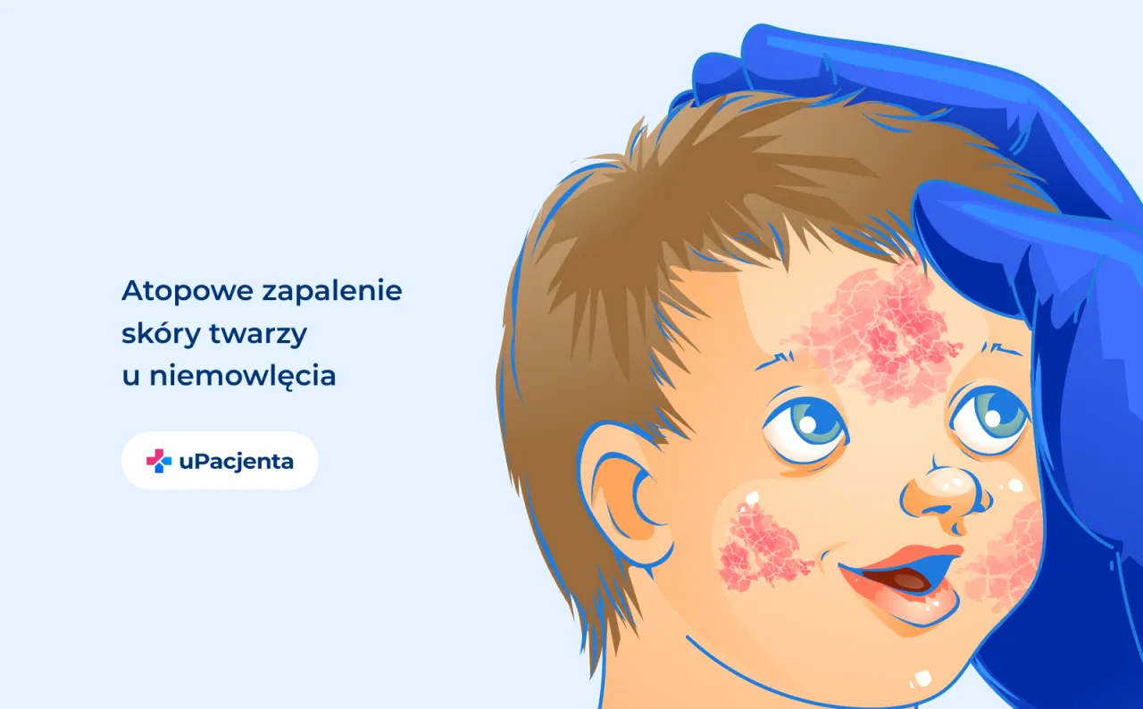 Zdjęcie Objawy AZS u niemowlaka: Jak rozpoznać i złagodzić uciążliwe dolegliwości