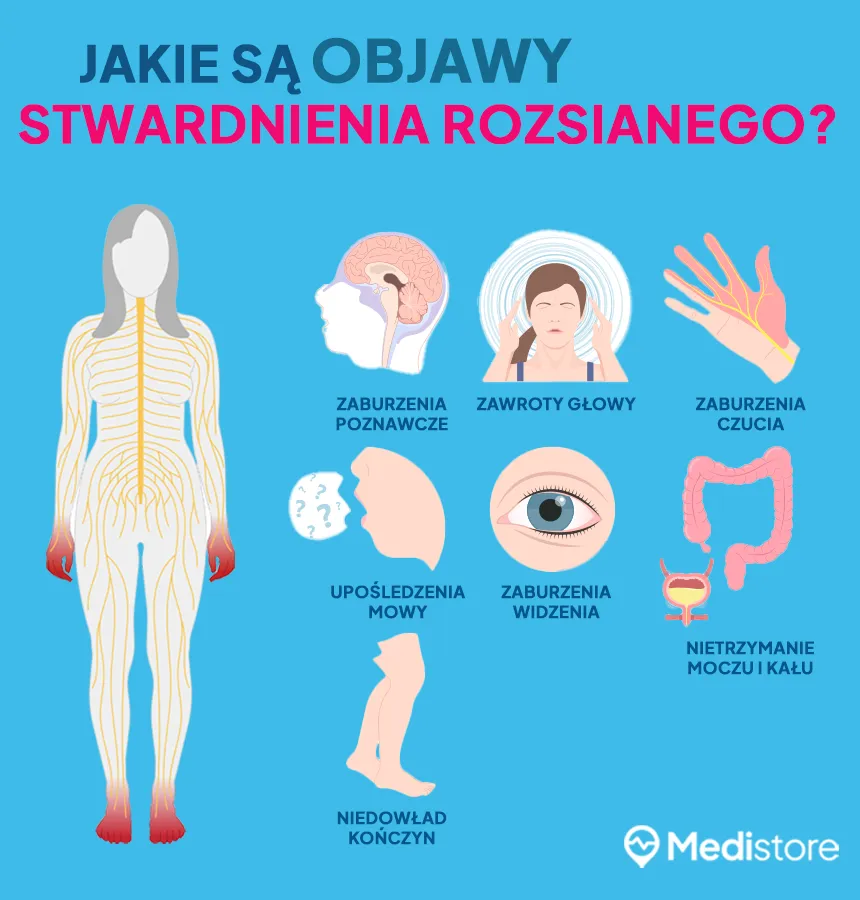 Zdjęcie Stwardnienie rozsiane: pierwsze objawy, które mogą Cię zaskoczyć