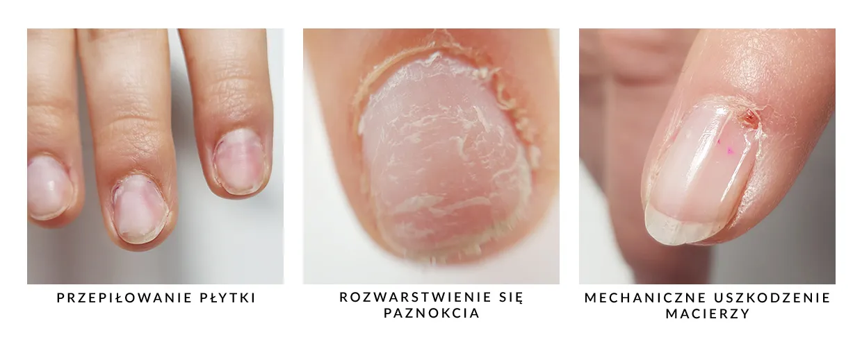 Zdjęcie Jak skutecznie zmatowić płytkę paznokcia i uniknąć błędów przed manicure