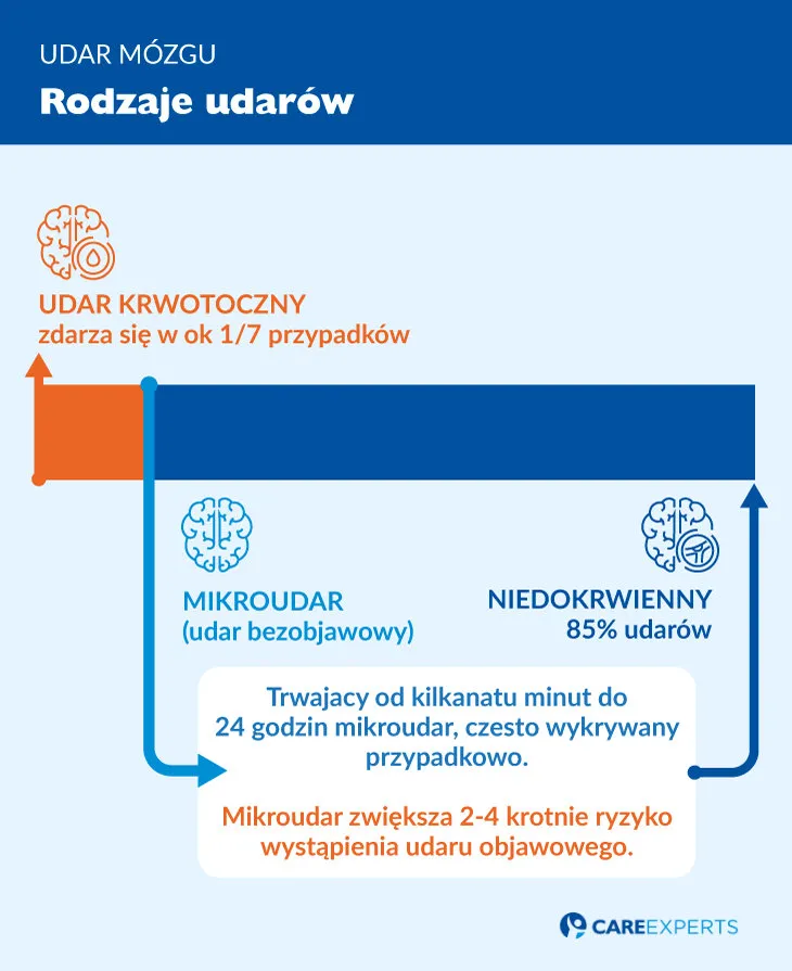 Zdjęcie Dlaczego udar nazywa się zawałem mózgu? Wyjaśnienie i kluczowe różnice