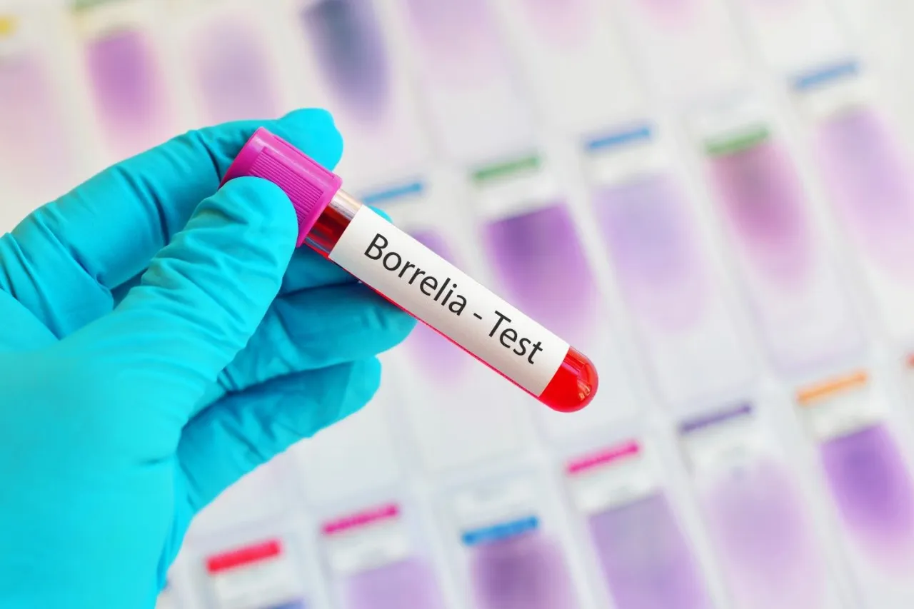 Zdjęcie Jakie badanie na boreliozę? Poznaj skuteczne metody diagnostyki