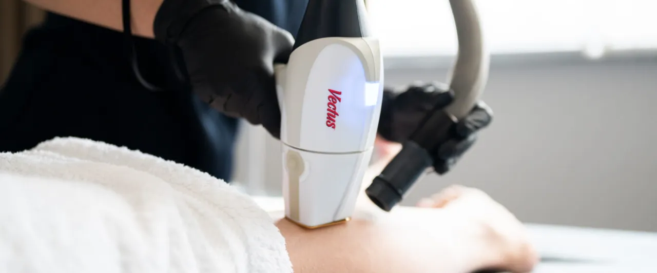 Zdjęcie Ile utrzymuje się depilacja laserowa? Poznaj prawdę o efektach