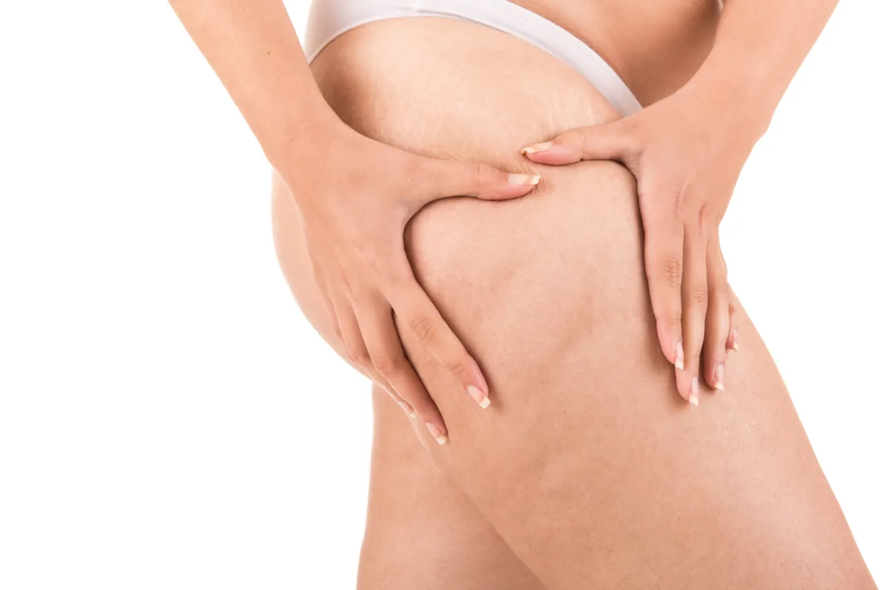 Zdjęcie Skuteczne zabiegi na cellulit: Onda i Endermologia bez bólu