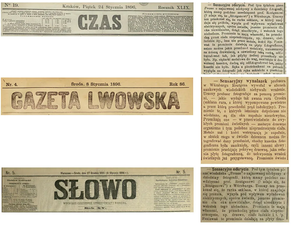 Zdjęcie Kto odkrył promienie X i jak zmieniły świat medycyny?