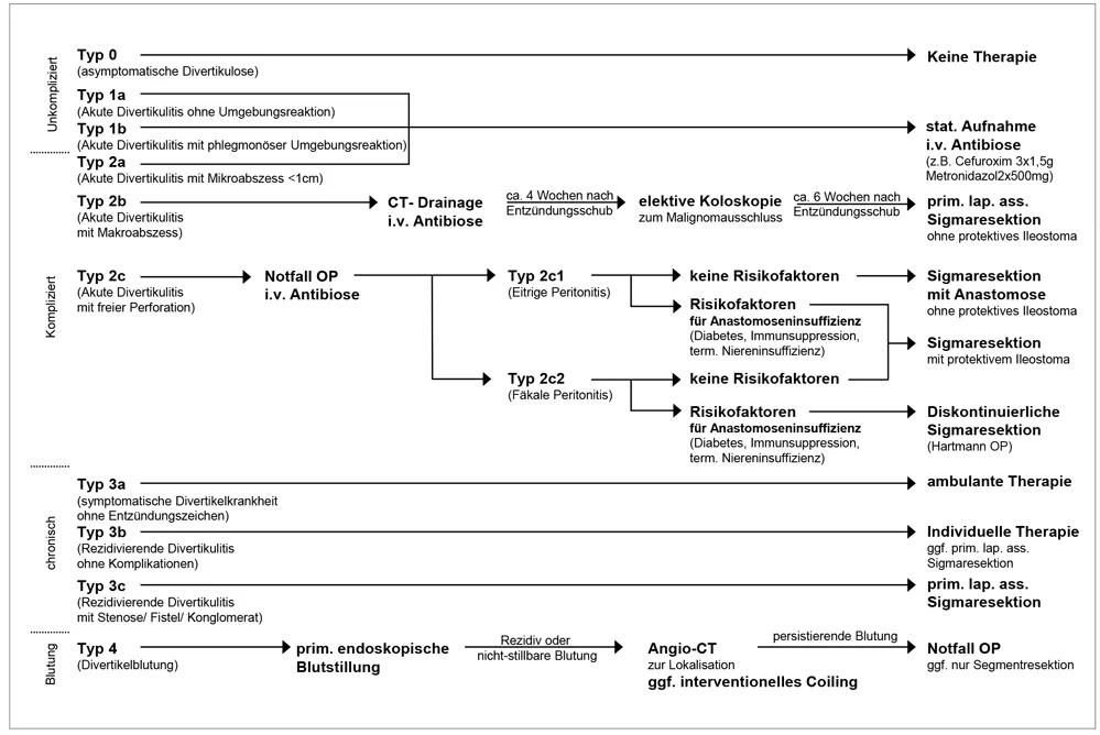 Zdjęcie Die wichtigsten Methoden zur Diagnostik von Divertikulose und ihre Risiken