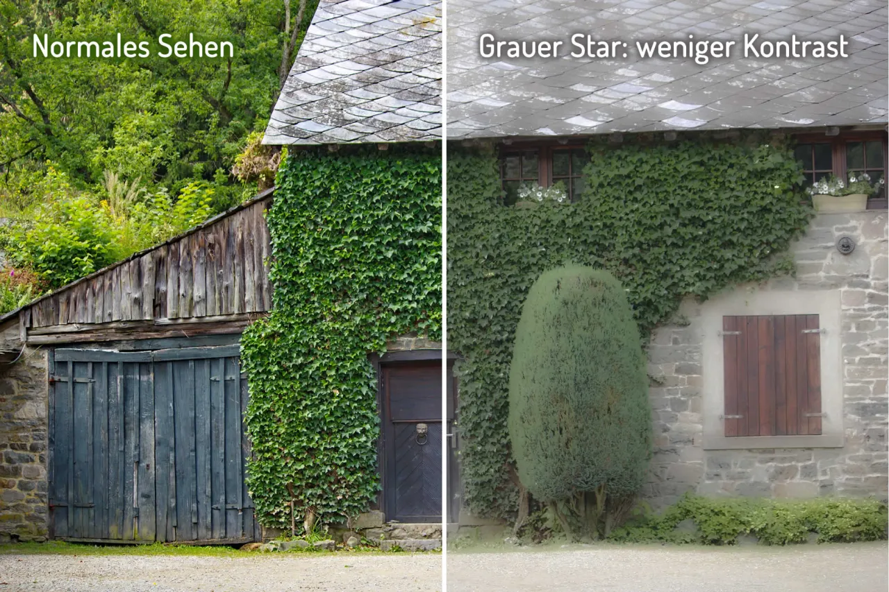 Zdjęcie Grauen Star Symptome: Erkennen Sie die Anzeichen rechtzeitig