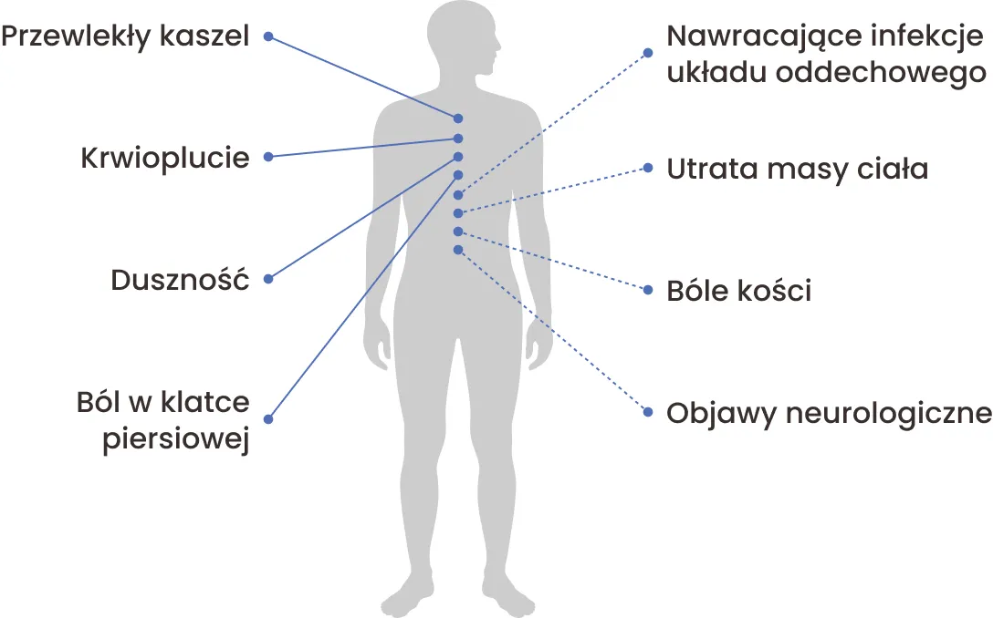 Zdjęcie Objawy nowotworu płuc – nie bagatelizuj tych niepokojących sygnałów