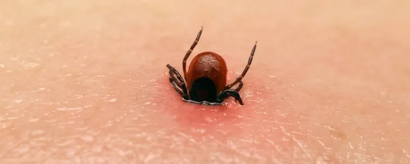 Zdjęcie Jak wygląda ukąszenie kleszcza i co warto o nim wiedzieć?