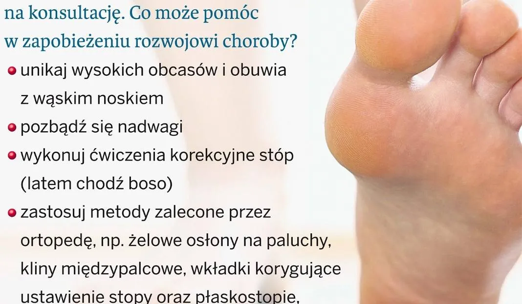 Zdjęcie Jak skutecznie ukryć haluksy i poprawić wygląd stóp bez operacji