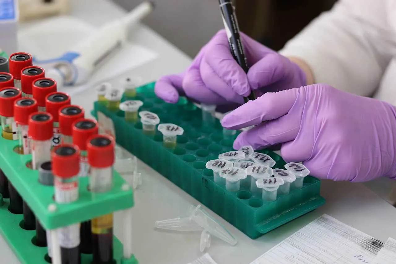 Zdjęcie Problemy hormonalne objawy: Jak rozpoznać i zrozumieć skutki?