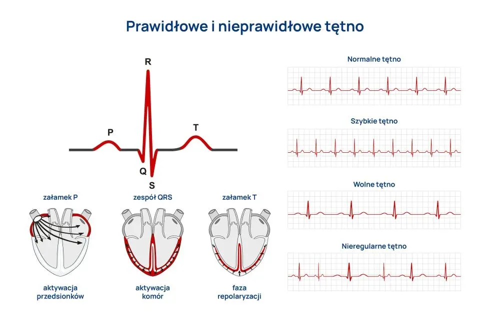 Zdjęcie Skoki ciśnienia - jakie badania są niezbędne w diagnostyce?