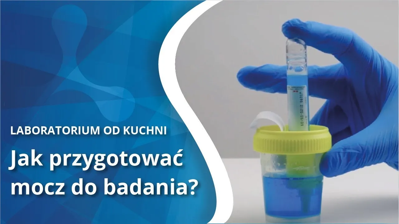 Zdjęcie Czy oddanie moczu przed badaniem jest konieczne? Sprawdź, co musisz wiedzieć!