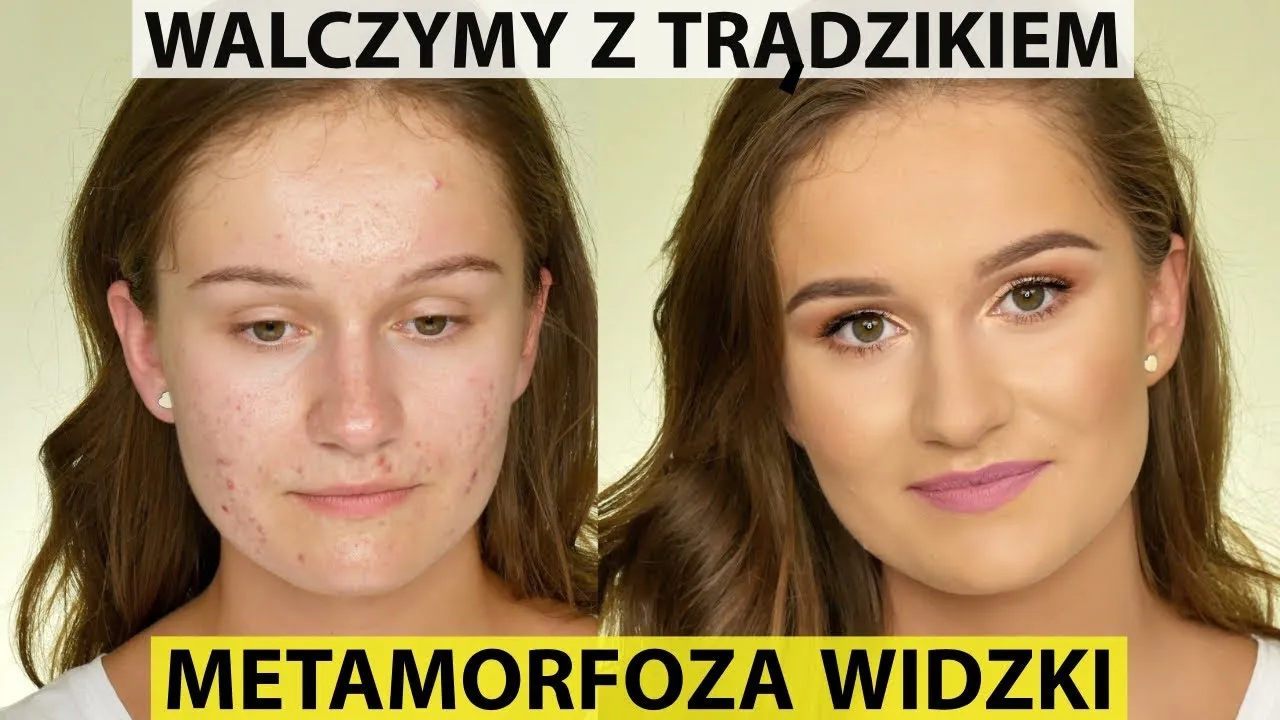 Zdjęcie Jak ukryć pryszcze makijażem i uzyskać naturalny efekt bez wysiłku