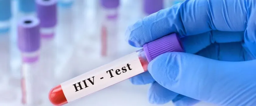 Zdjęcie Jak wygląda badanie na HIV? Co musisz wiedzieć przed testem