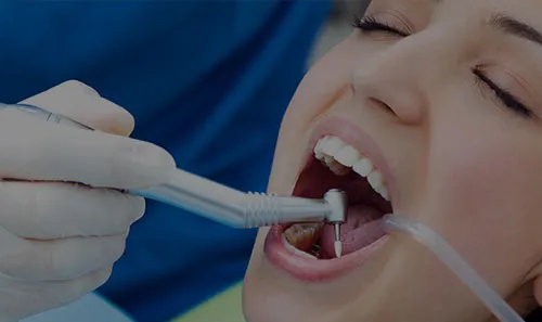 Zdjęcie Ile czasu po dentyście nie można jeść? Ważne informacje dla Ciebie