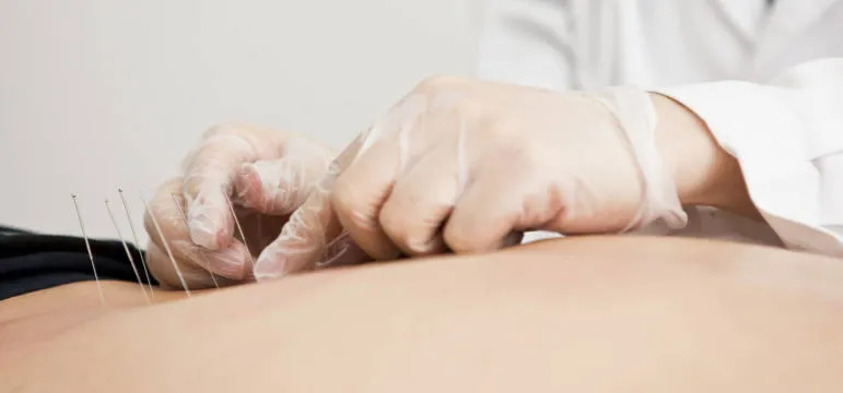 Zdjęcie Jak lekarz medycyny chińskiej może poprawić twoje zdrowie i samopoczucie