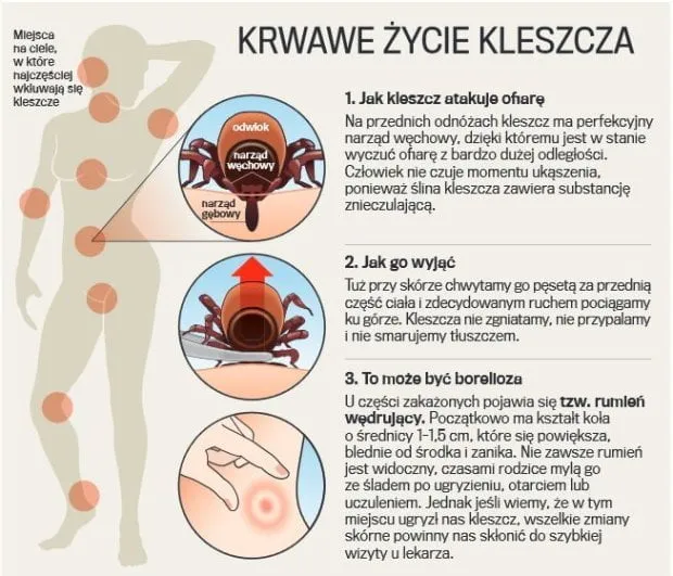 Zdjęcie Kleszcz u człowieka – co robić, by uniknąć groźnych chorób i błędów?