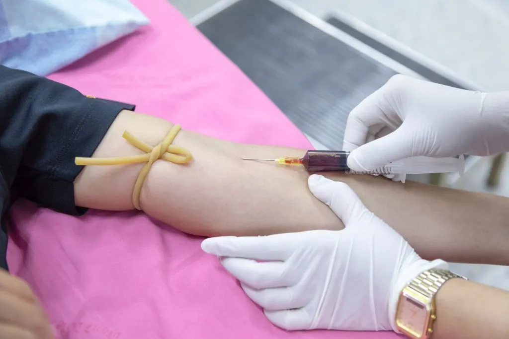 Zdjęcie Co zjeść na kolację przed badaniem cholesterolu, aby uniknąć błędów?