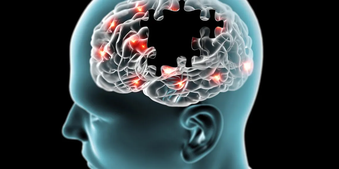 Zdjęcie Jakie badania na Alzheimera? Kompleksowy przegląd diagnostyki