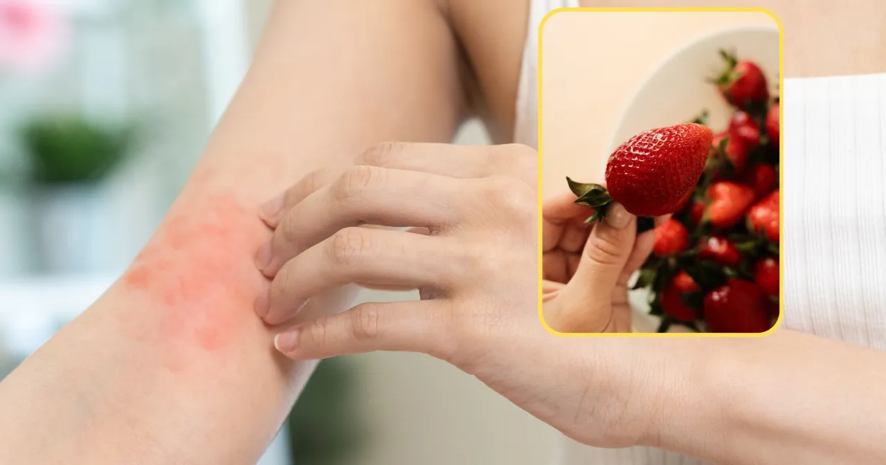 Zdjęcie Czy truskawki uczulają niemowlaki? Objawy i kiedy je wprowadzić