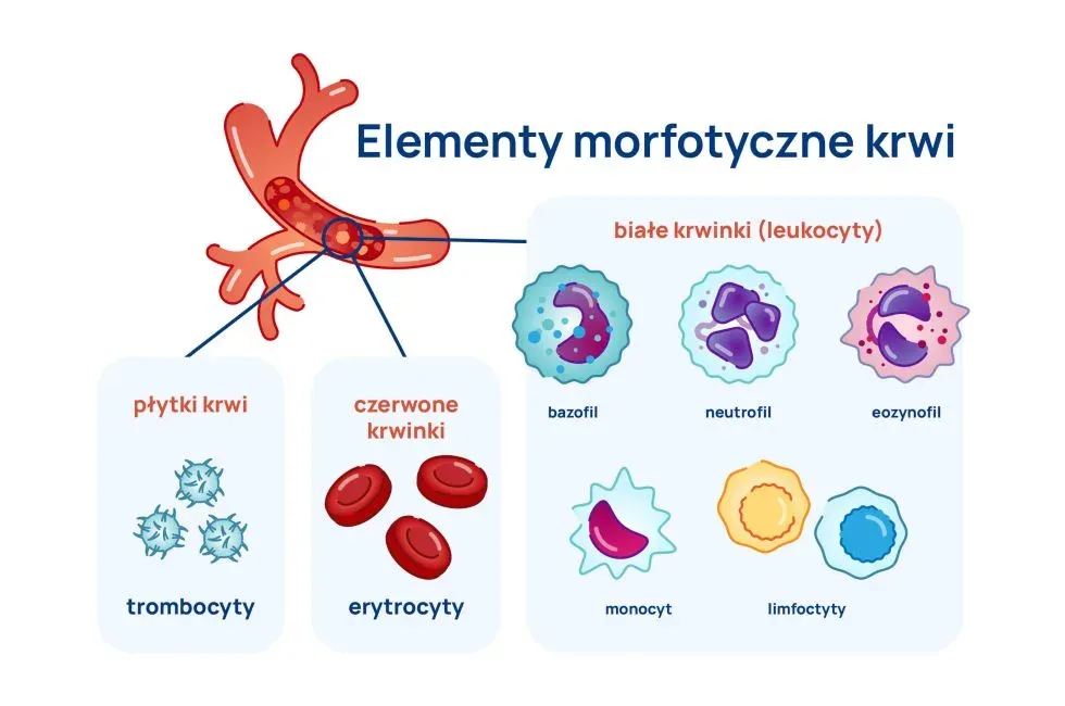 Zdjęcie Podwyższony poziom leukocytów we krwi – co to oznacza i jakie są przyczyny?
