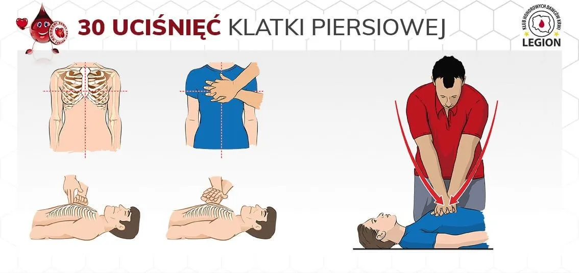Zdjęcie Pierwsza pomoc: ile uciśnięć i ile wdechów w resuscytacji?