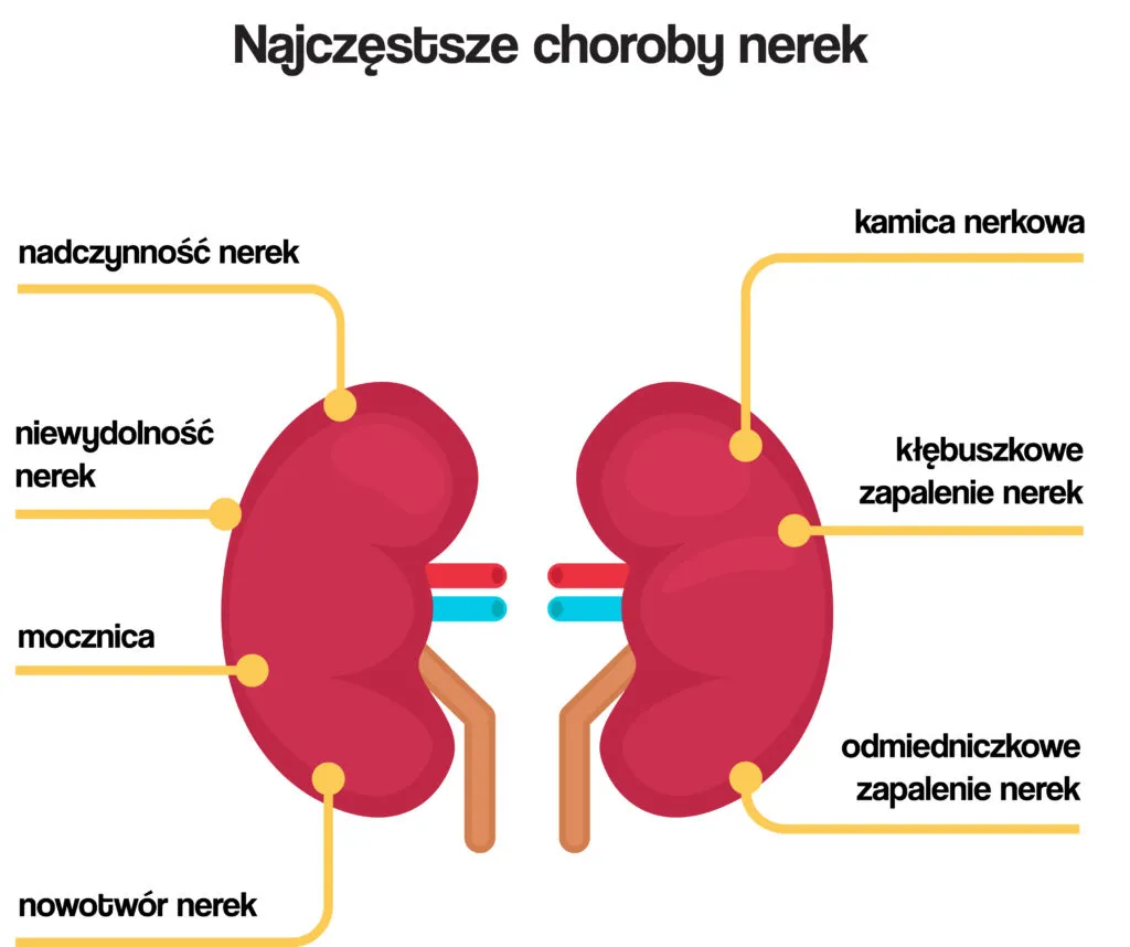 Zdjęcie Czy badanie moczu wykryje choroby nerek? Kluczowe informacje, które musisz znać