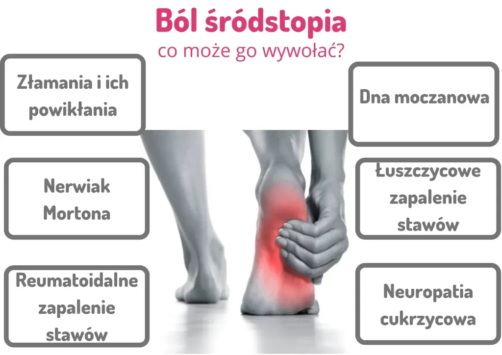 Zdjęcie Ból śródstopia przyczyna: poznaj najczęstsze źródła dyskomfortu