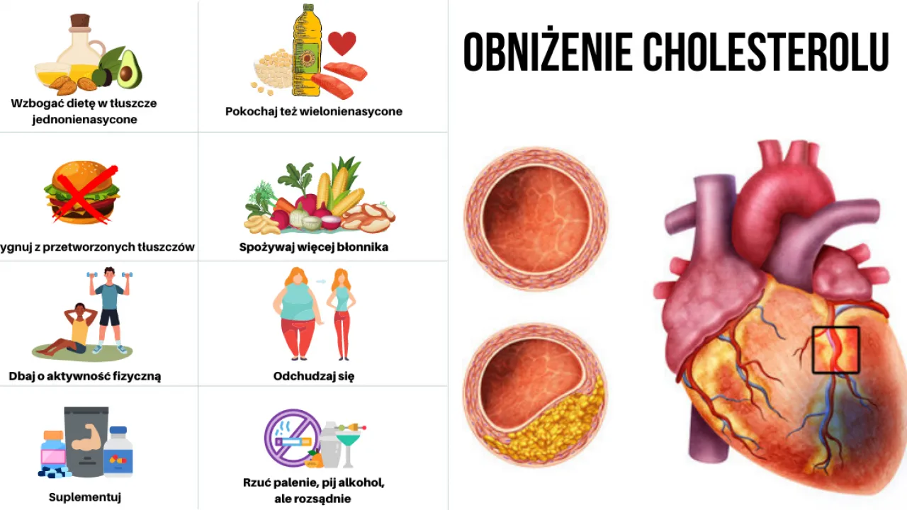 Zdjęcie Skuteczne metody na podwyższony poziom cholesterolu, które musisz znać
