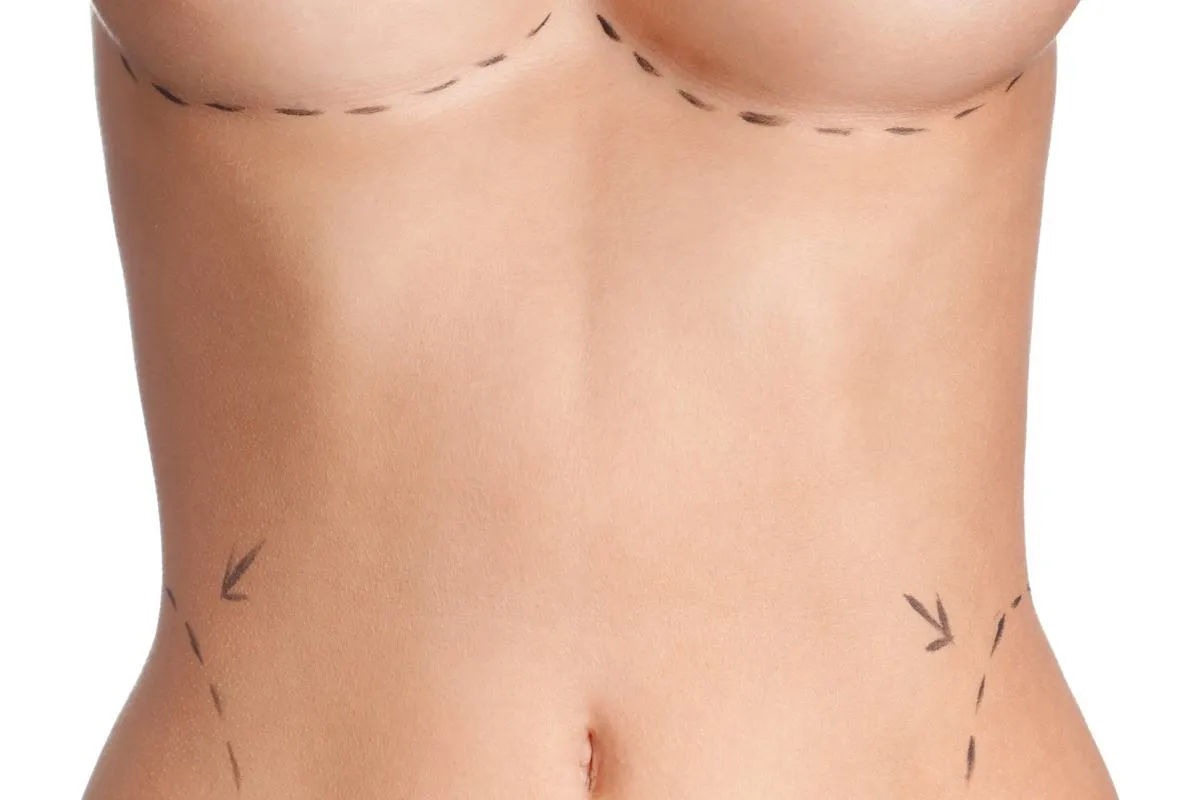 Zdjęcie Zmniejszenie biustu NFZ: ile się czeka na operację i co wpływa na czas?