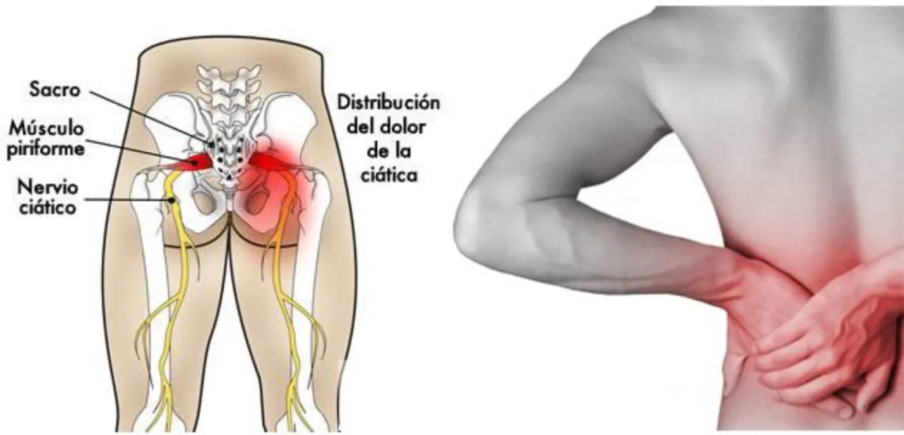 Zdjęcie &iquest;Es ci&aacute;tica? Reconoce s&iacute;ntomas, causas y cu&aacute;ndo actuar