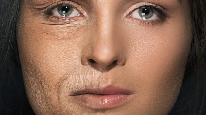 Zdjęcie Niedobory krzemu objawy: Jak rozpoznać skutki braku krzemu?