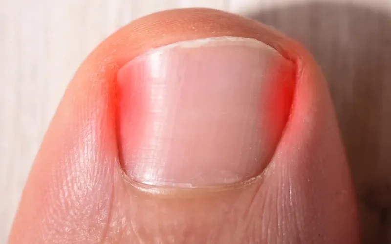 Zdjęcie Jak nazywa się lekarz od paznokci u rąk i kiedy go odwiedzić?