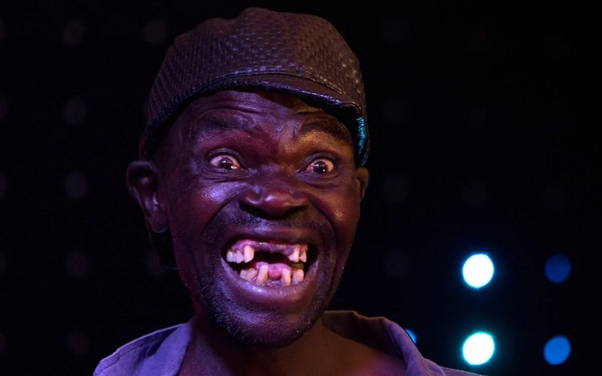 Zdjęcie Najbrzydszy chłopak świata: Kim jest i dlaczego jest znany?