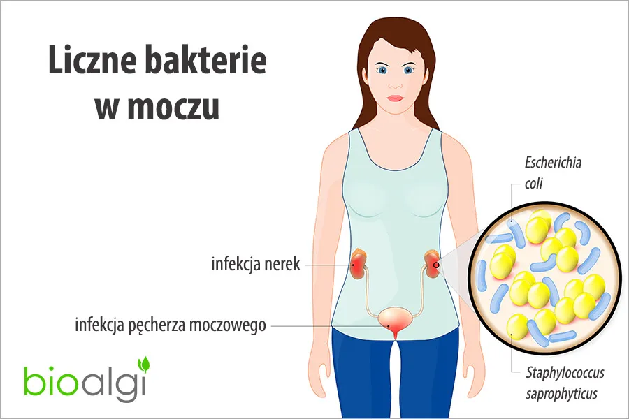 Zdjęcie Skąd się biorą bakterie w moczu? Poznaj przyczyny i objawy bakteriomoczu