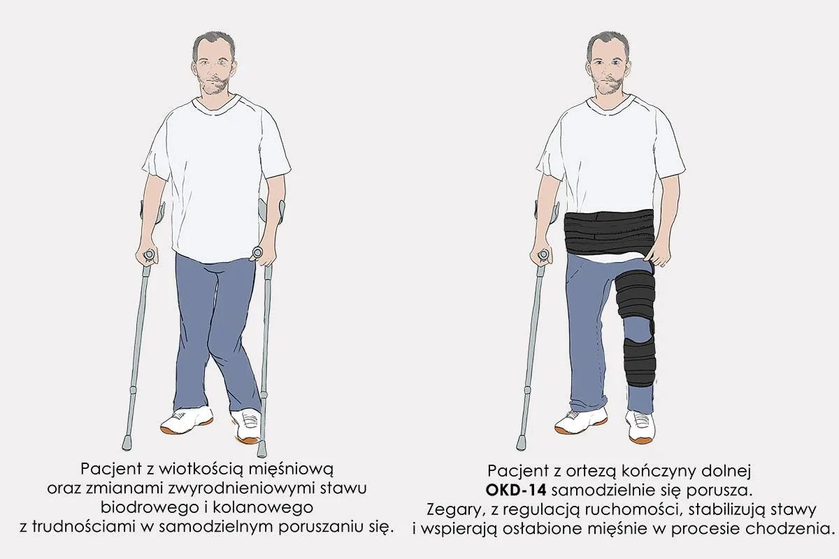 Zdjęcie Jak chodzić w ortezie po schodach bez ryzyka kontuzji i bólu