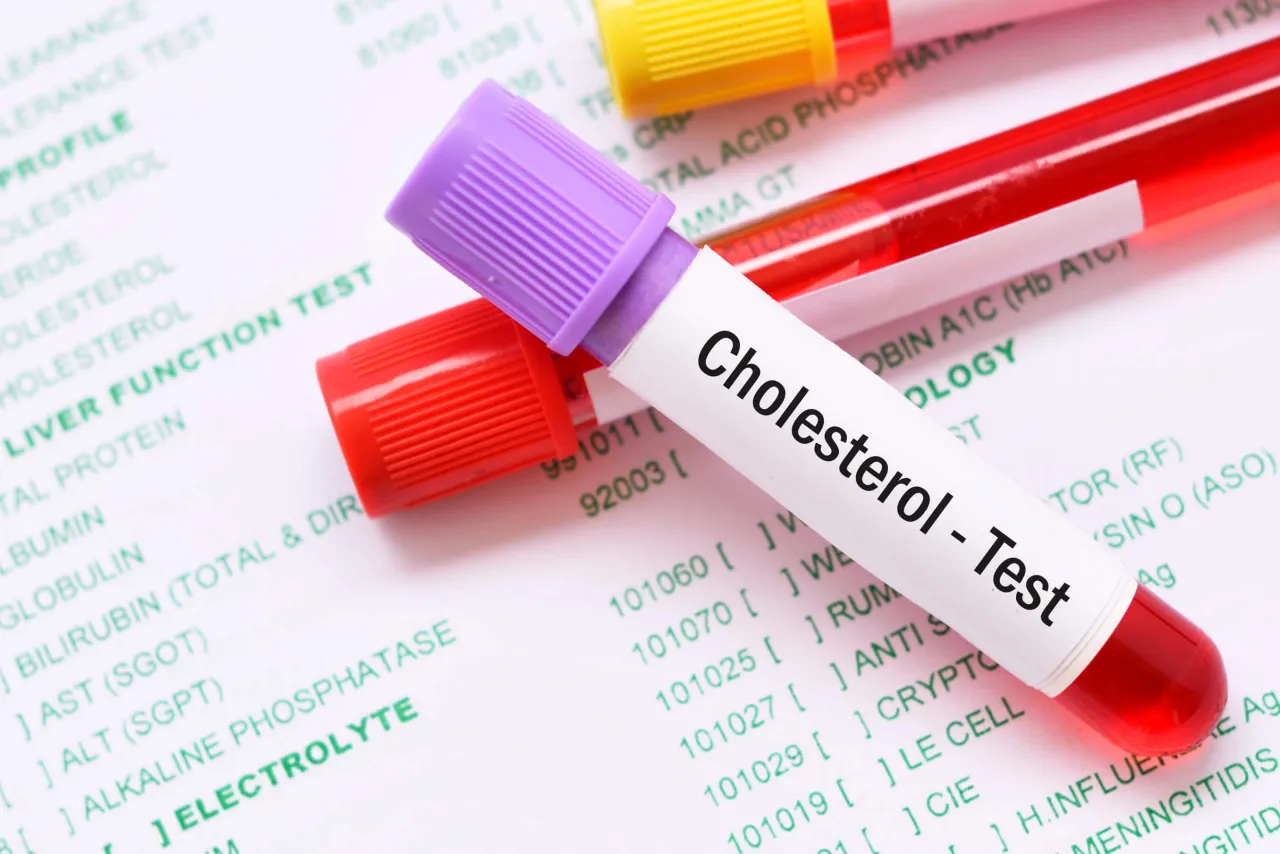 Zdjęcie Jak czytać wyniki cholesterolu i uniknąć poważnych problemów zdrowotnych