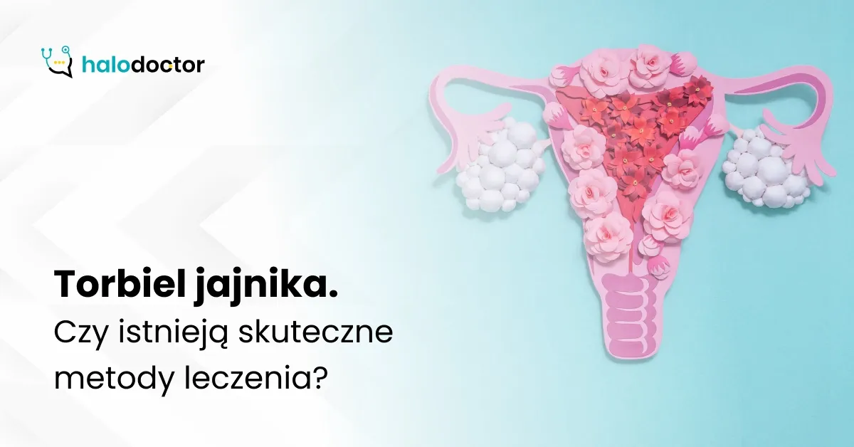 Zdjęcie Jakie leki hormonalne na torbiel jajnika mogą skutecznie pomóc?