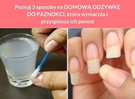 Zdjęcie Dopuszczalny odrost paznokci: normy estetyczne i zawodowe