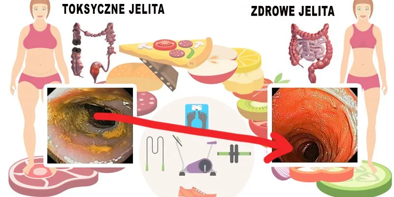 Zdjęcie Przepisy na zdrowe jelita, które poprawią Twoje trawienie i samopoczucie