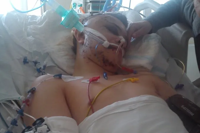 Zdjęcie Co czuje człowiek w śpiączce farmakologicznej? Niezwykłe doświadczenia i tajemnice