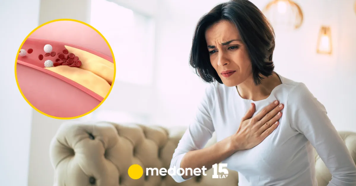 Zdjęcie Wysoki cholesterol jaki lekarz - kluczowe informacje dla zdrowia