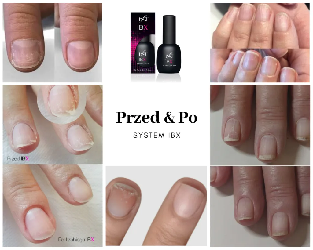 Zdjęcie IBX czy manicure japoński - porównanie zabiegów i efektów pielęgnacji