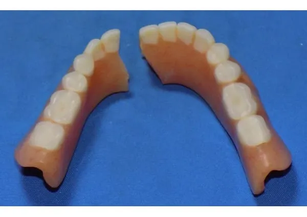 Zdjęcie Pęknięta proteza? Jak naprawić tymczasowo i kiedy iść do protetyka