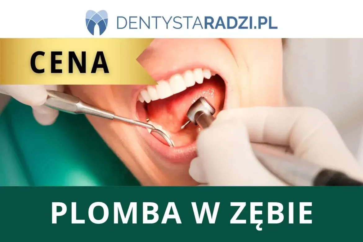 Zdjęcie Ile kosztuje plomba na NFZ? Sprawdź refundację i ukryte koszty