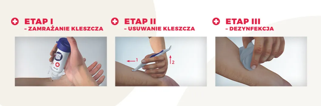 Zdjęcie Jak uniknąć boreliozy? Praktyczny poradnik ochrony przed kleszczami